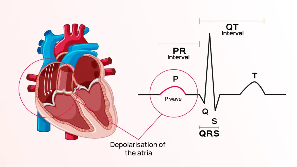 P Wave ECG Abnormalities and Its Role in Cardiac Wellness