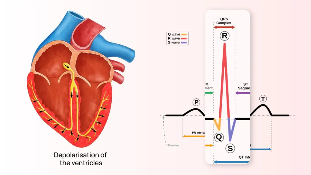 Understanding QRS Complex Abnormalities in Cardiac Health