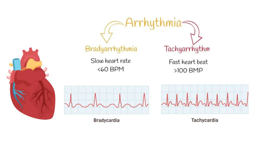 What is the Difference between Tachycardia and Bradycardia?