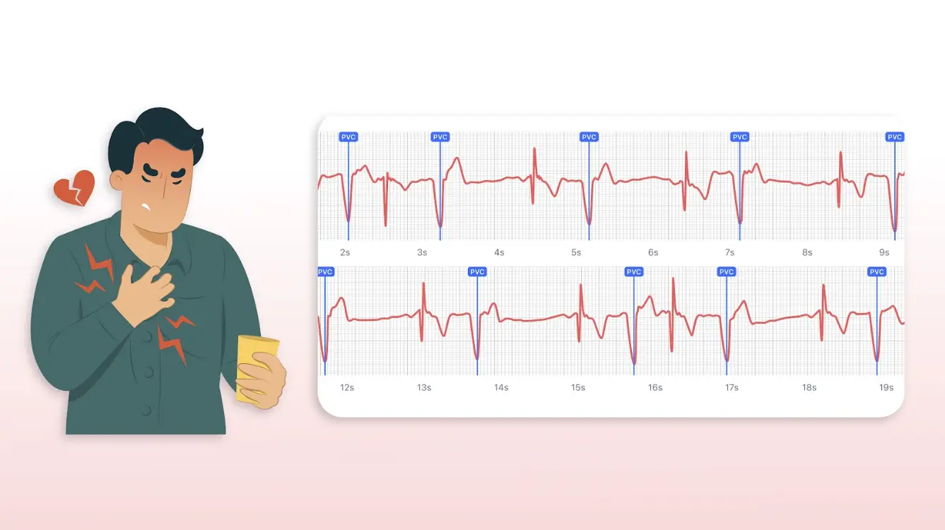 Heart Palpitations are frequent? Know when to seek help