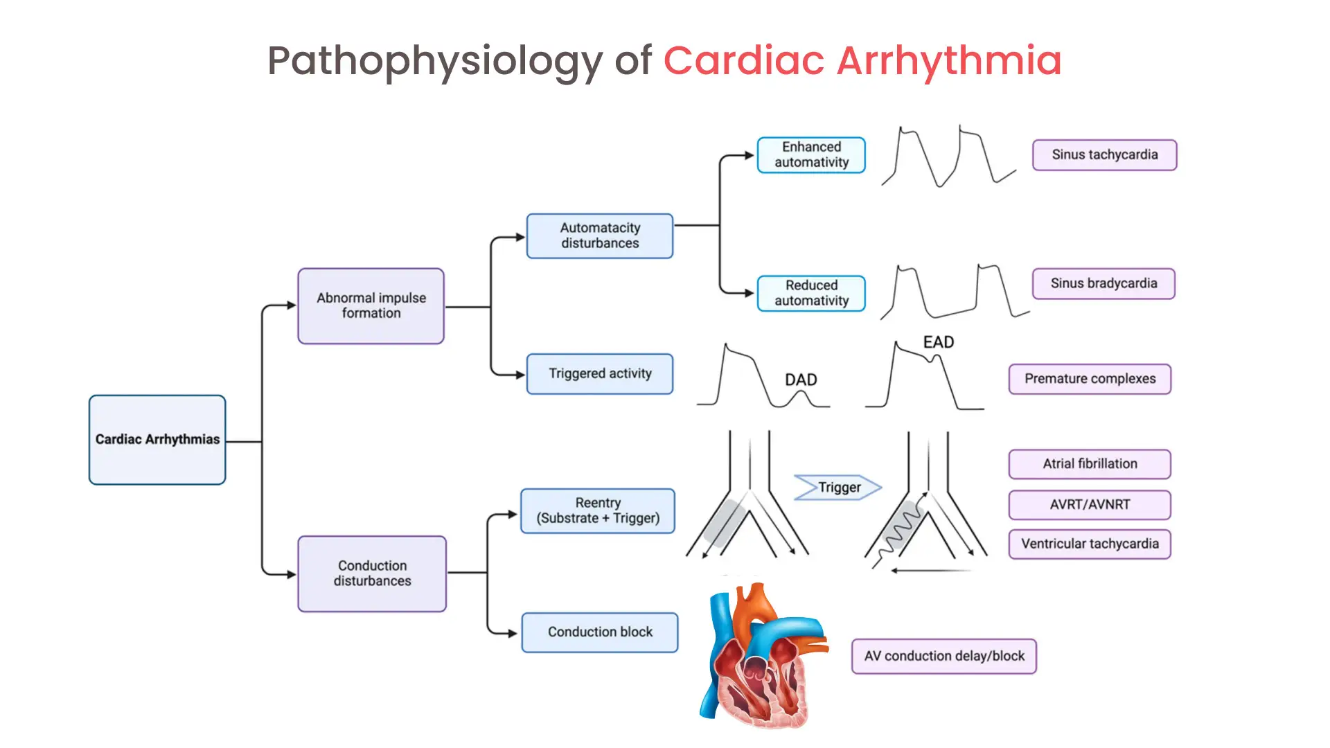 Understanding the Pathophysiology of Cardiac Arrhythmia