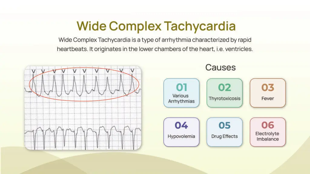 What Happens in Wide Complex Tachycardia?