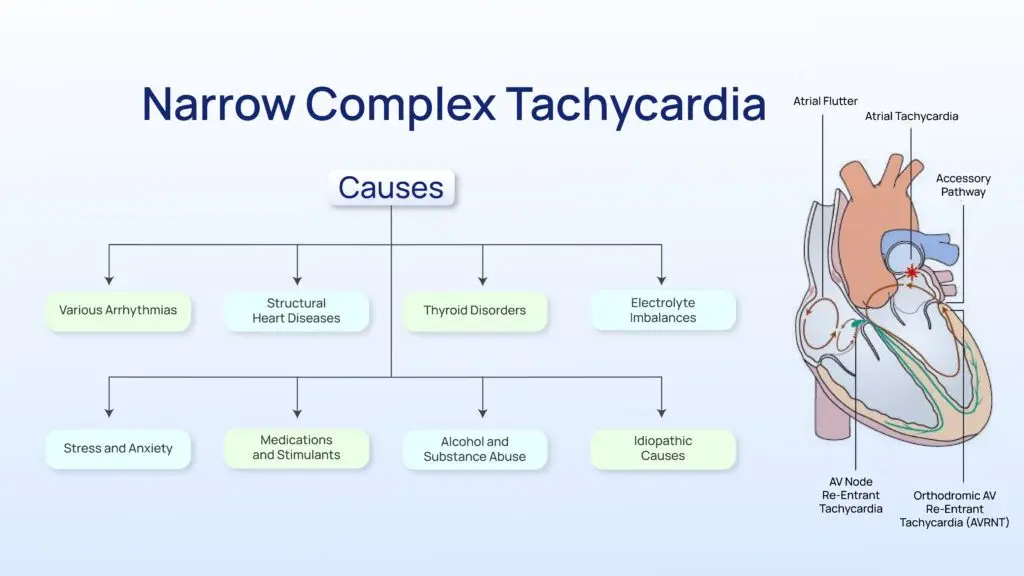 What is Narrow Complex Tachycardia?