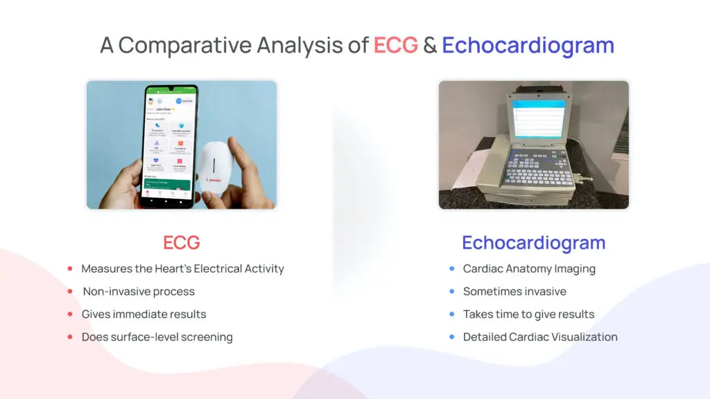 Decoding ECG vs Echocardiogram: A Comparative Analysis