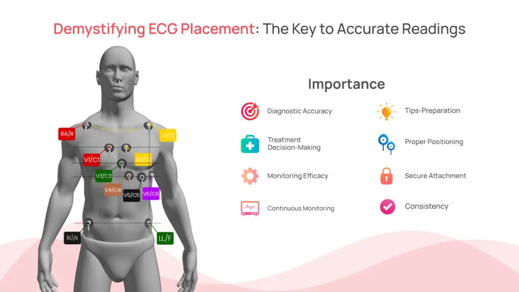 Demystifying ECG Placement: The Key to Accurate Readings