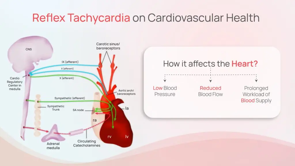 Impact of Reflex Tachycardia on Cardiovascular Health