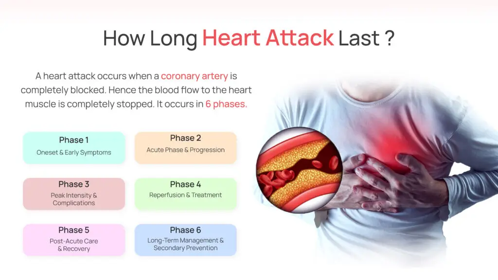 How Long Heart Attack Last?