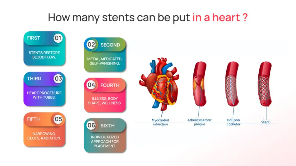 How many Stents can be put in a Heart?