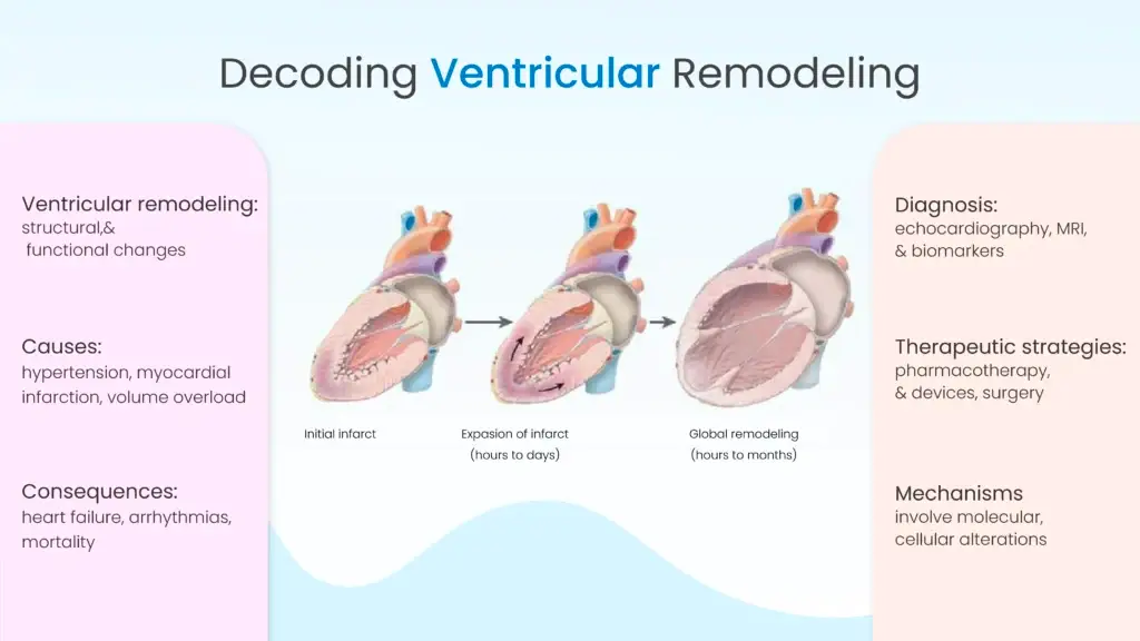 Decoding Ventricular Remodeling