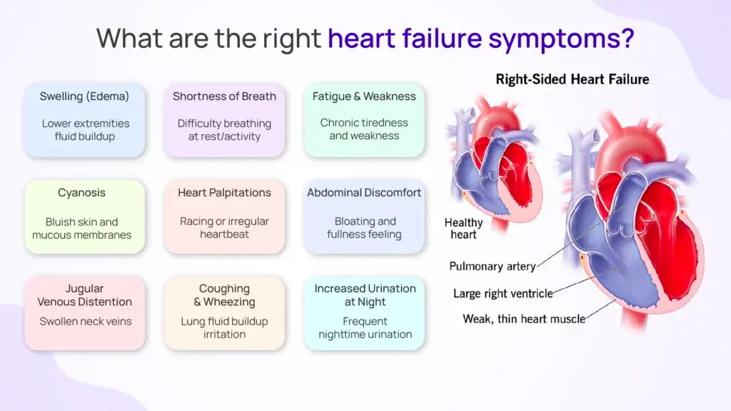 What are the Right Heart Failure Symptoms?