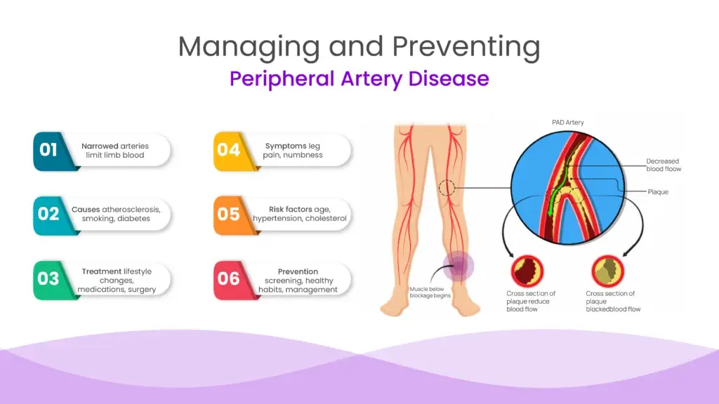Managing and Preventing Peripheral Artery Disease