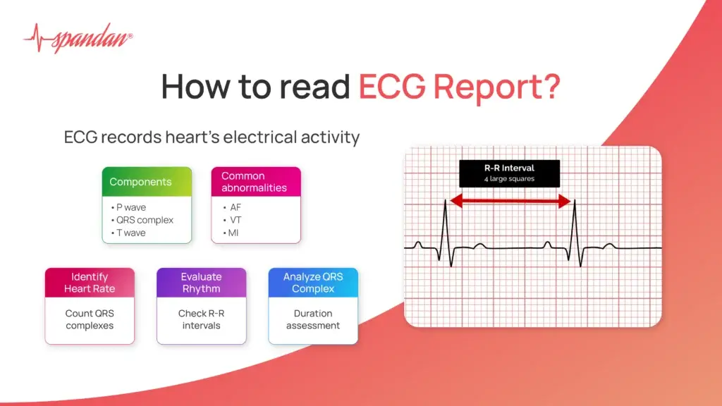 How to Read ECG Report?