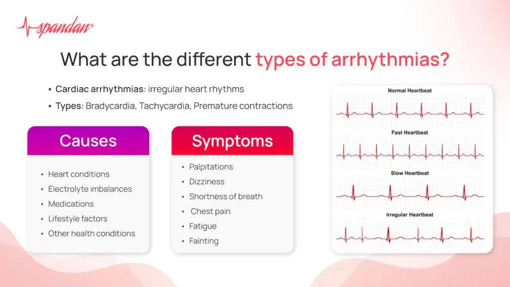 What are the Different Types of Arrhythmias?