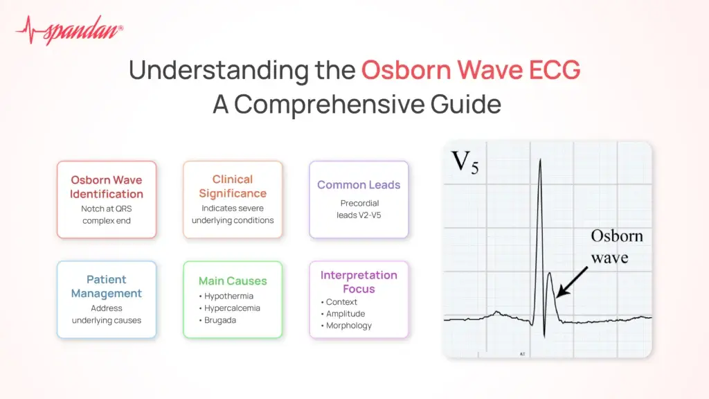 Understanding the Osborn Wave ECG: A Comprehensive Guide