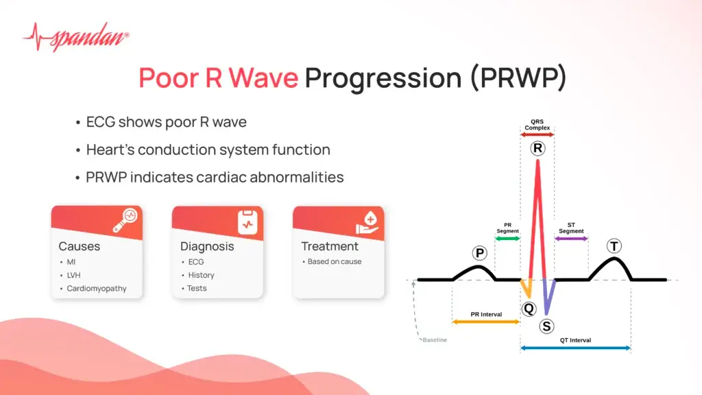 Poor R Wave Progression (PRWP)