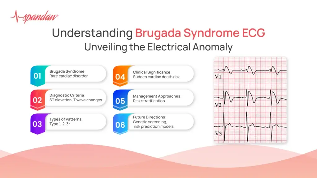 Understanding Brugada Syndrome ECG: Unveiling the Electrical Anomaly