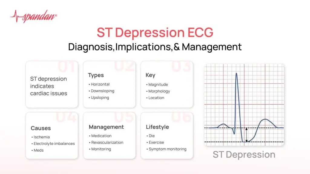ST Depression ECG: Diagnosis, Implications, and Management