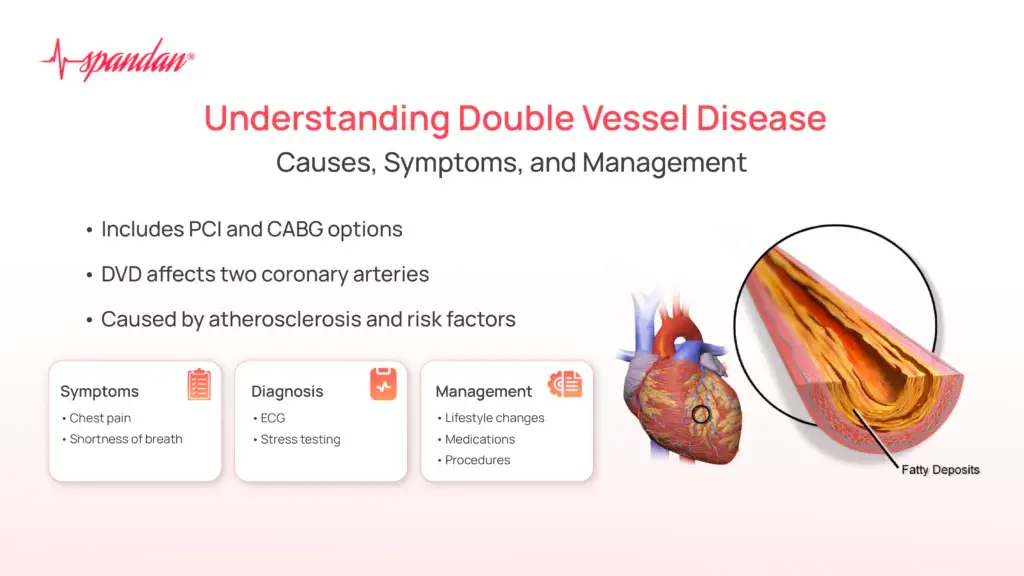 Understanding Double Vessel Disease: Causes, Symptoms, and Management