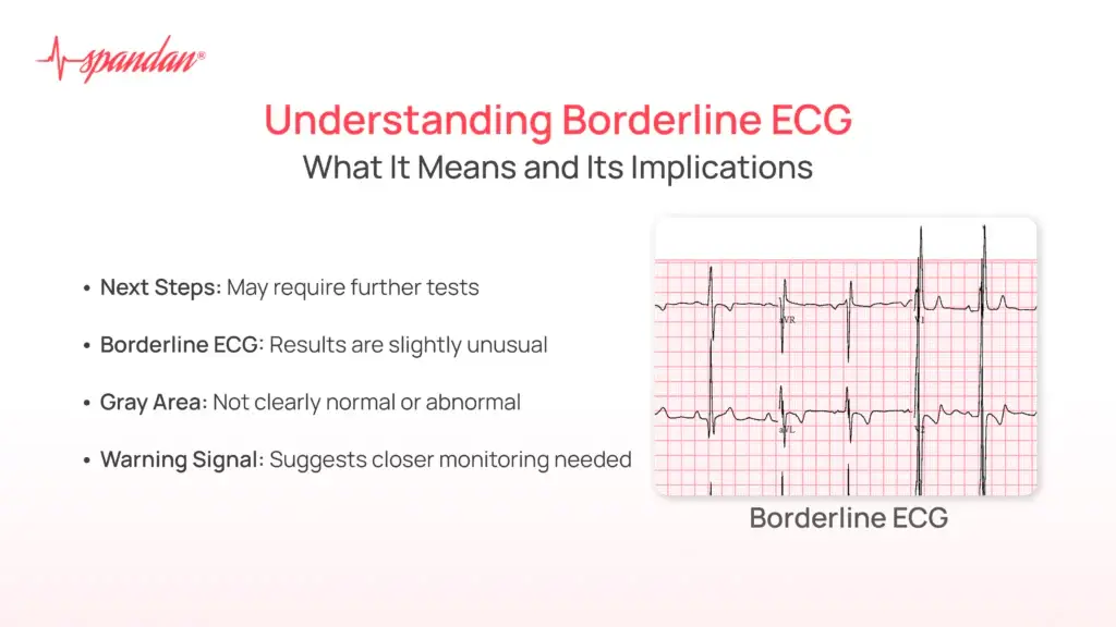 Understanding Borderline ECG: What It Means and Its Implications