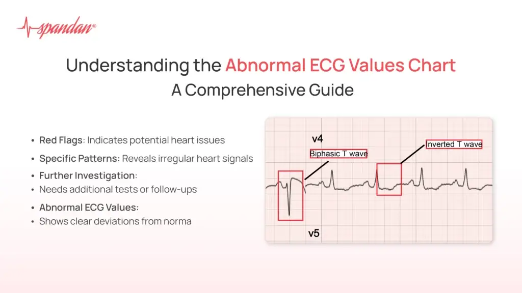 Understanding the Abnormal ECG Values Chart: A Comprehensive Guide
