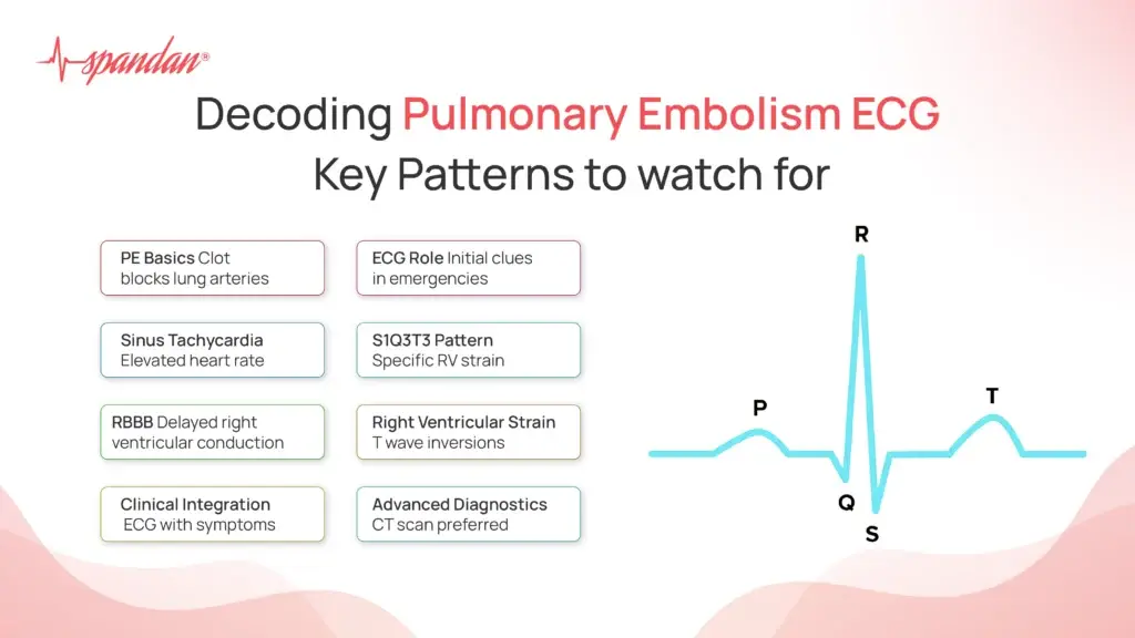 Decoding Pulmonary Embolism ECG: Key Patterns to Watch For