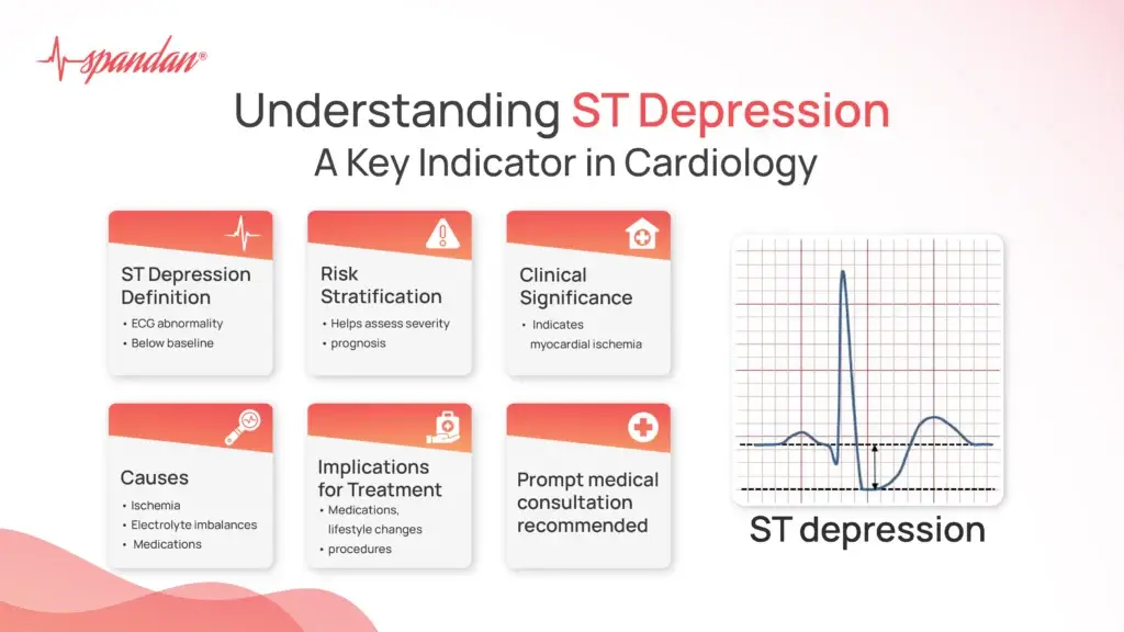 Understanding ST Depression: A Key Indicator in Cardiology
