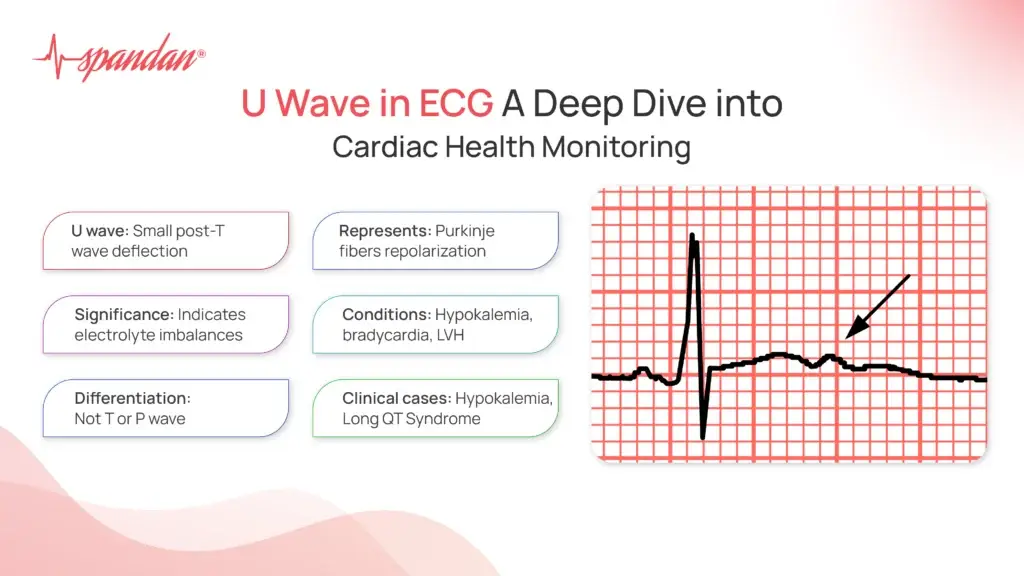 U Wave in ECG: A Deep Dive into Cardiac Health Monitoring