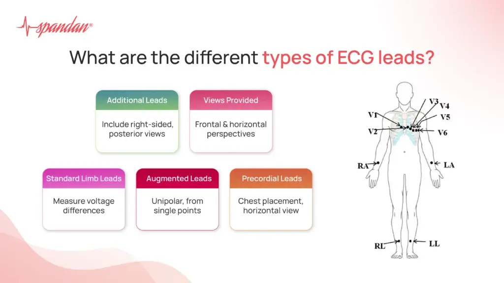 What are the different types of ECG leads?
