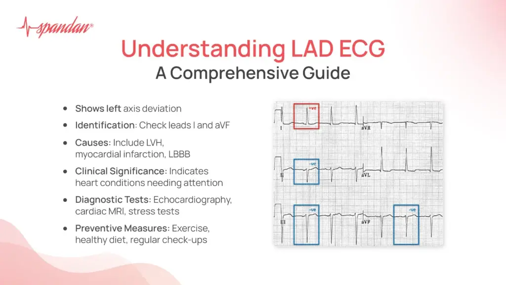 Understanding LAD ECG: A Comprehensive Guide
