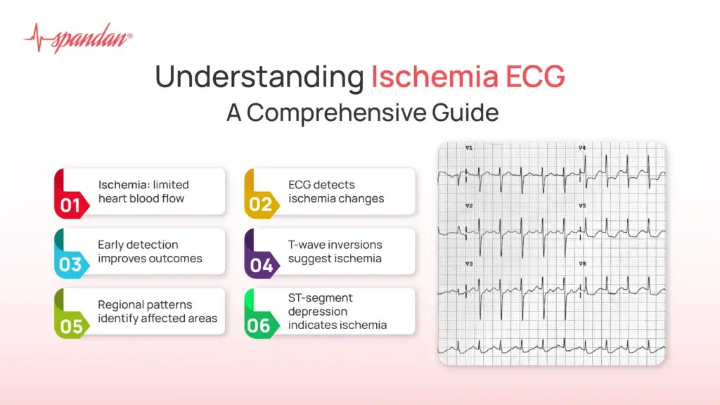 Understanding Ischemia ECG: A Comprehensive Guide