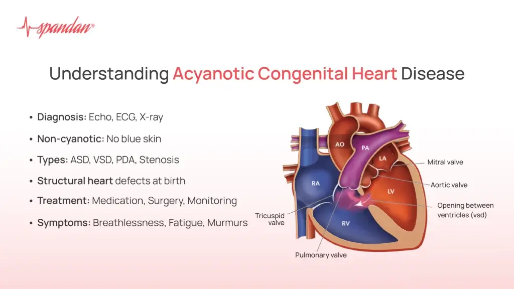 Understanding Acyanotic Congenital Heart Disease