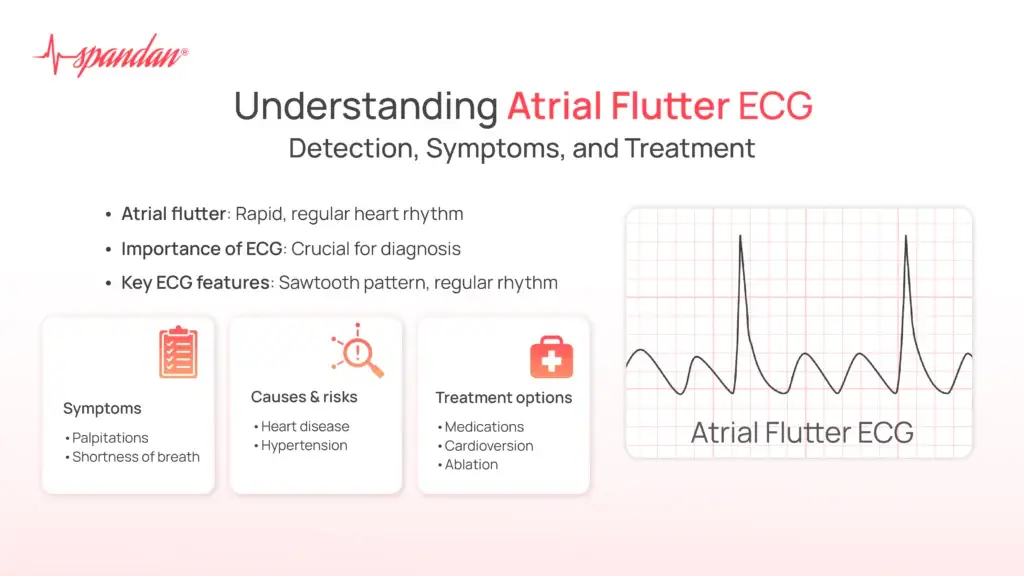 Understanding Atrial Flutter ECG: Detection, Symptoms, and Treatment