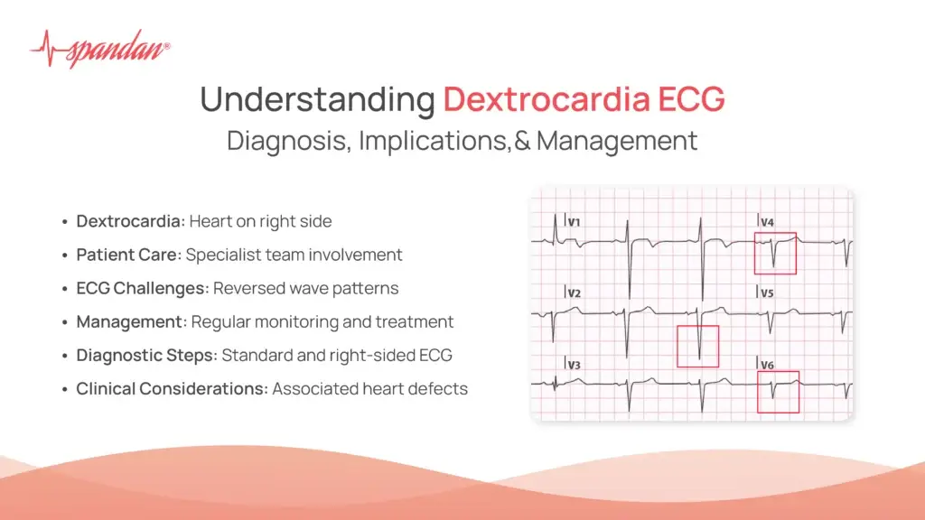 Understanding Dextrocardia ECG: Diagnosis, Implications, and Management