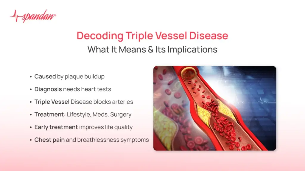 Decoding Triple Vessel Disease: What It Means and Its Implications