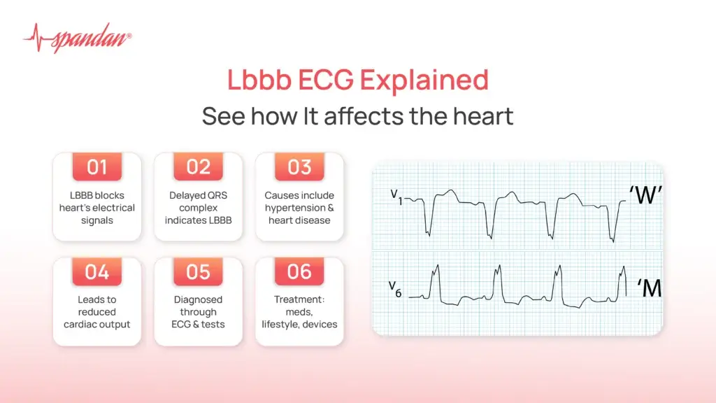 Lbbb ECG Explained: See how It affects the heart
