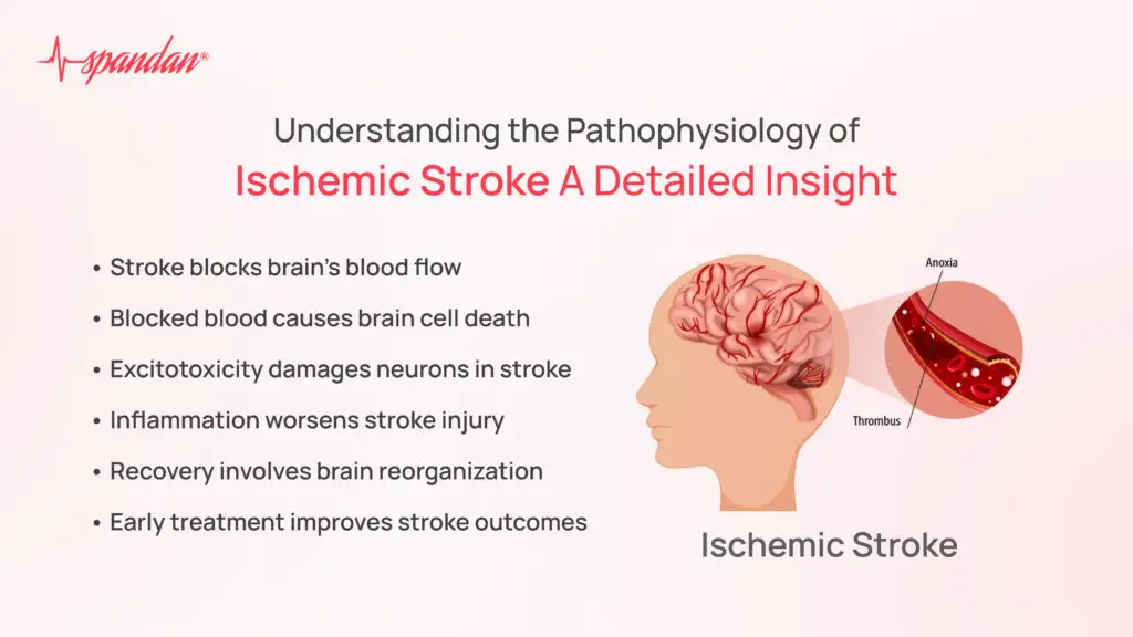Understanding the Pathophysiology of Ischemic Stroke: A Detailed Insight