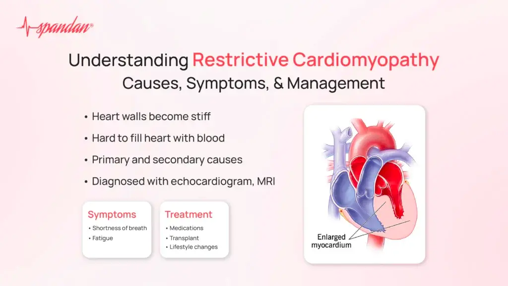 Understanding Restrictive Cardiomyopathy: Causes, Symptoms, and Management