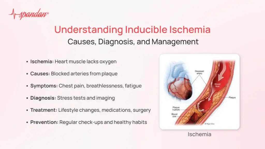 Understanding Inducible Ischemia: Causes, Diagnosis, and Management