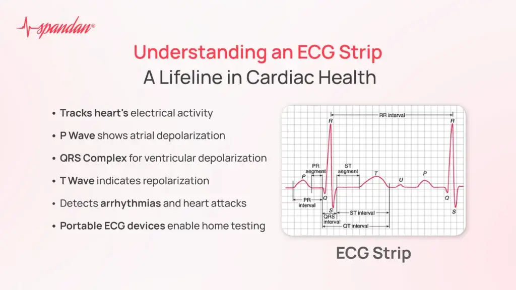 Understanding an ECG Strip: A Lifeline in Cardiac Health
