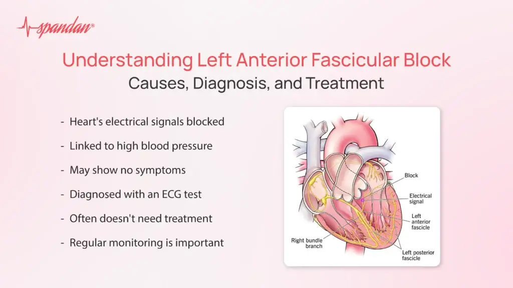 Left Anterior Fascicular Block: Causes,Diagnosis & Treatment