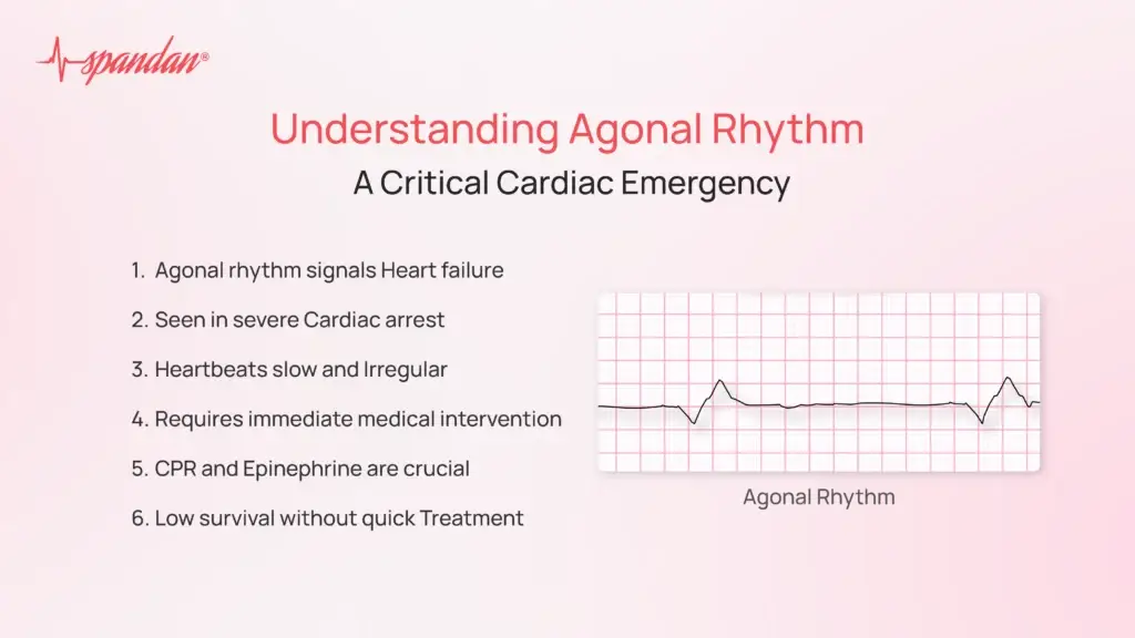 Understanding Agonal Rhythm: A Critical Cardiac Emergency