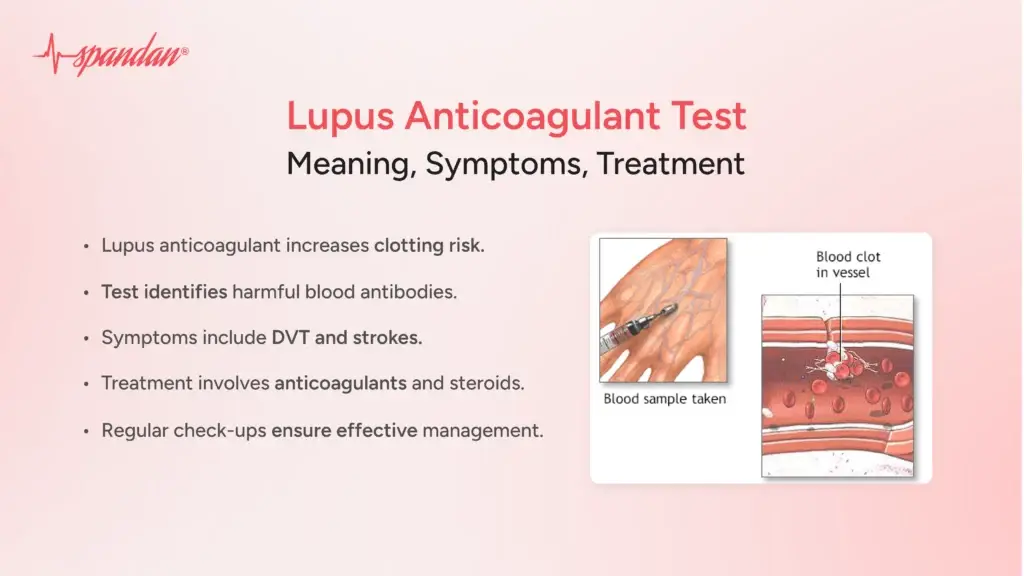 Lupus Anticoagulant Test: Meaning, Symptoms, Treatment