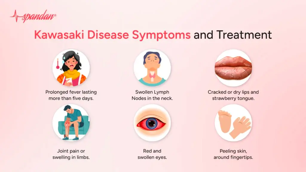 Kawasaki Disease Symptoms and Treatment