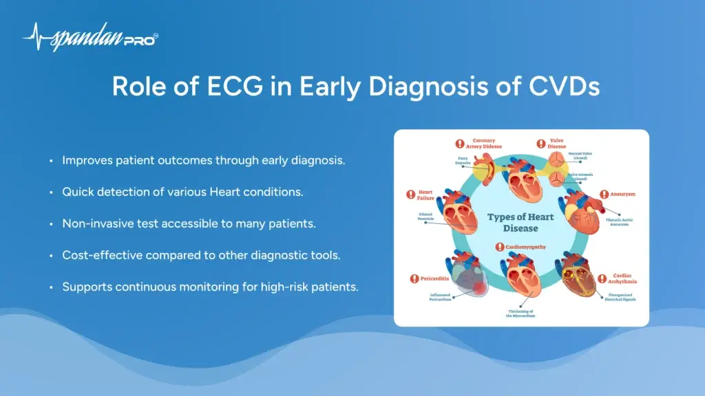 The Role of ECG in Early Diagnosis of CVDs