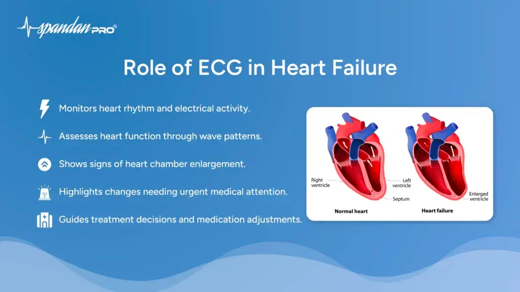Role of ECG in Heart Failure